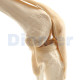 Classic Knee Joint